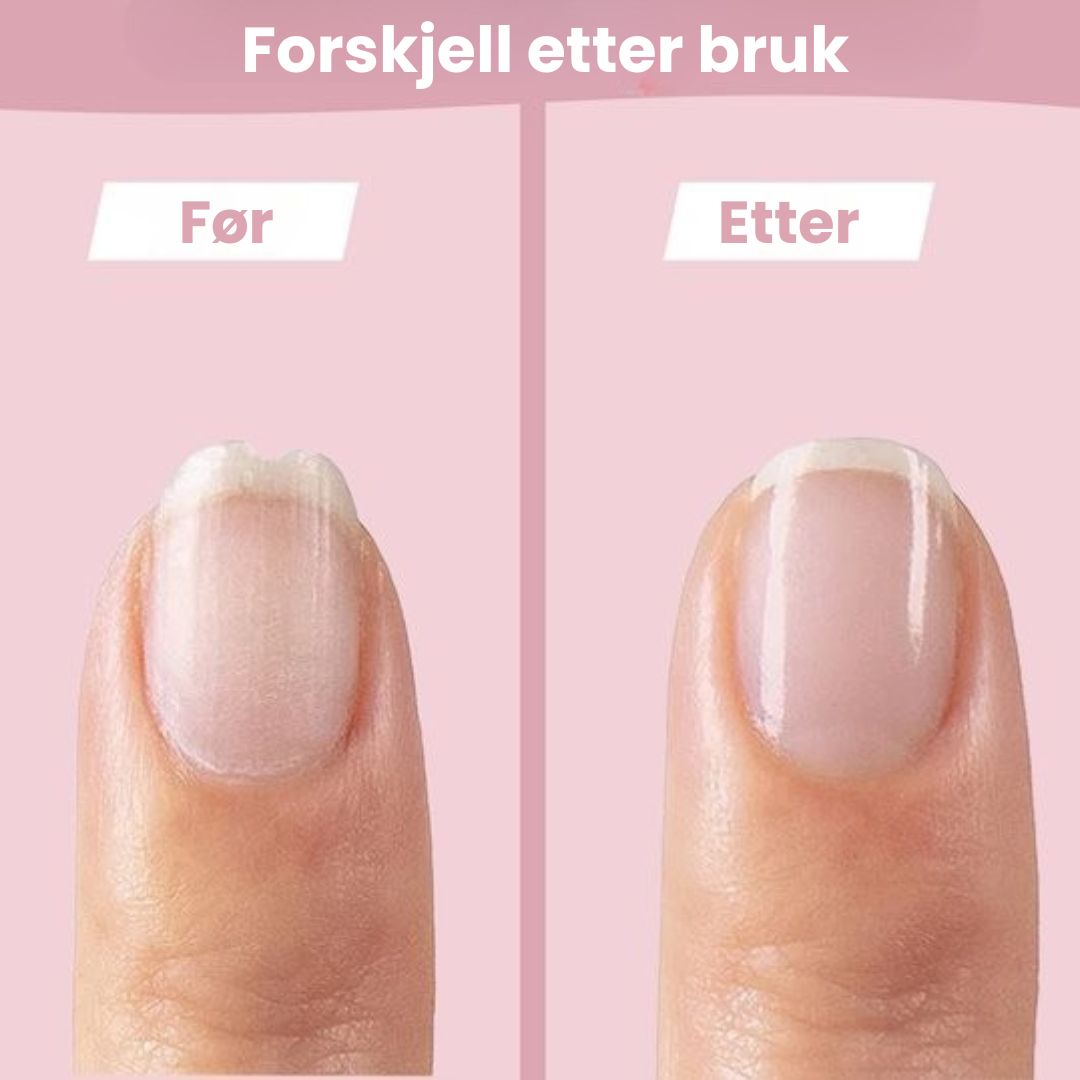 SafeCare – Støysvakt og sikkert – Elektrisk neglefilsett til babyer