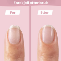 Thumbnail for SafeCare – Støysvakt og sikkert – Elektrisk neglefilsett til babyer